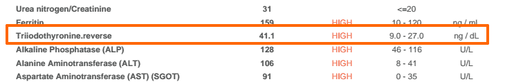 an example of an extremely high reverse t3 level lab test result. 