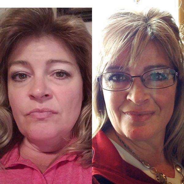 dani before after thyroid weight loss Dani before after thyroid weight loss