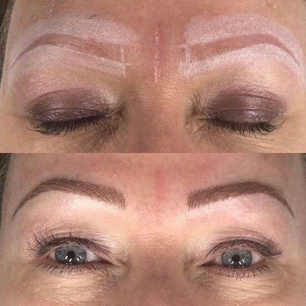 before and after pictures of a women who underwent microblading for her eyebrows.