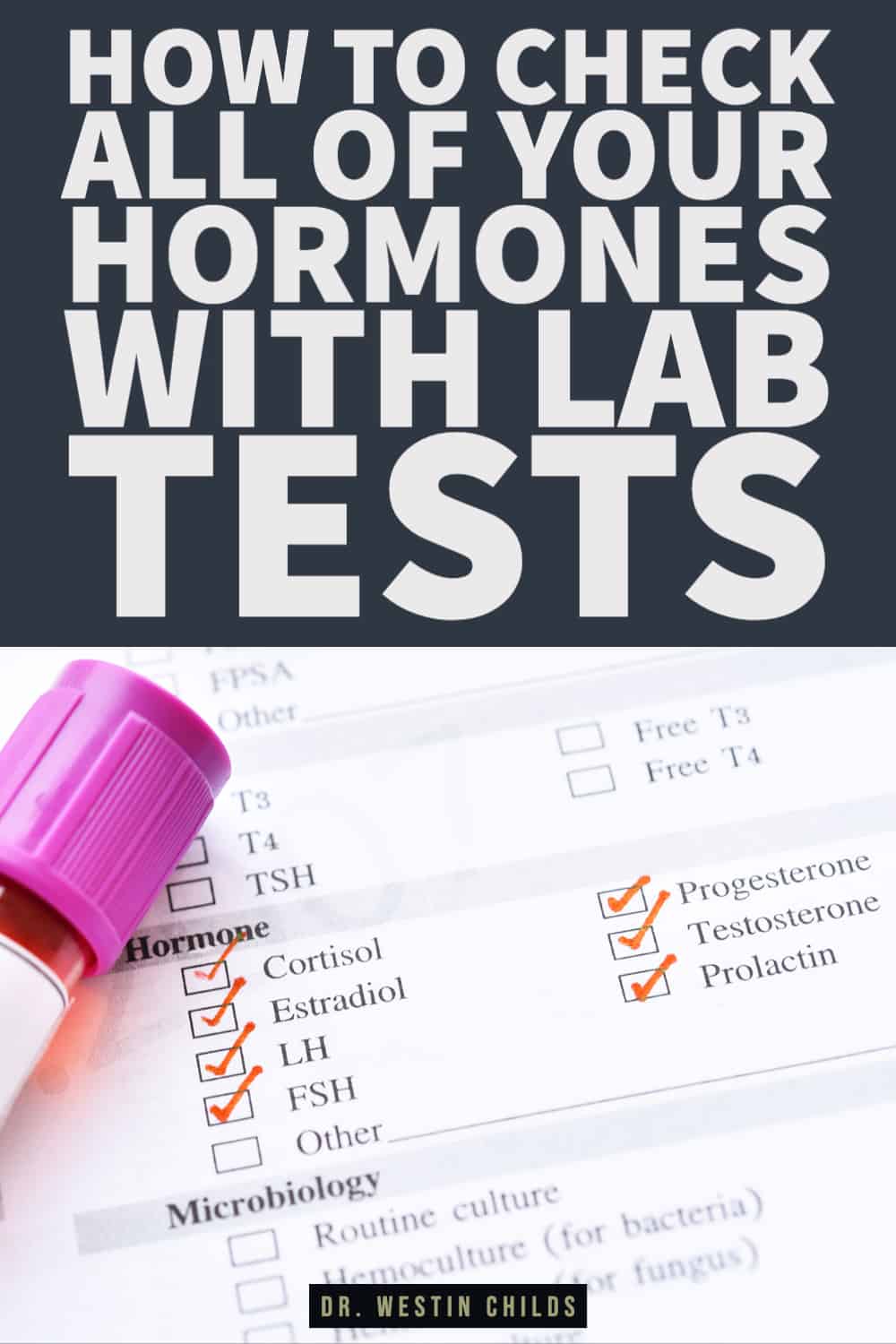 How to check all of your hormones with lab tests