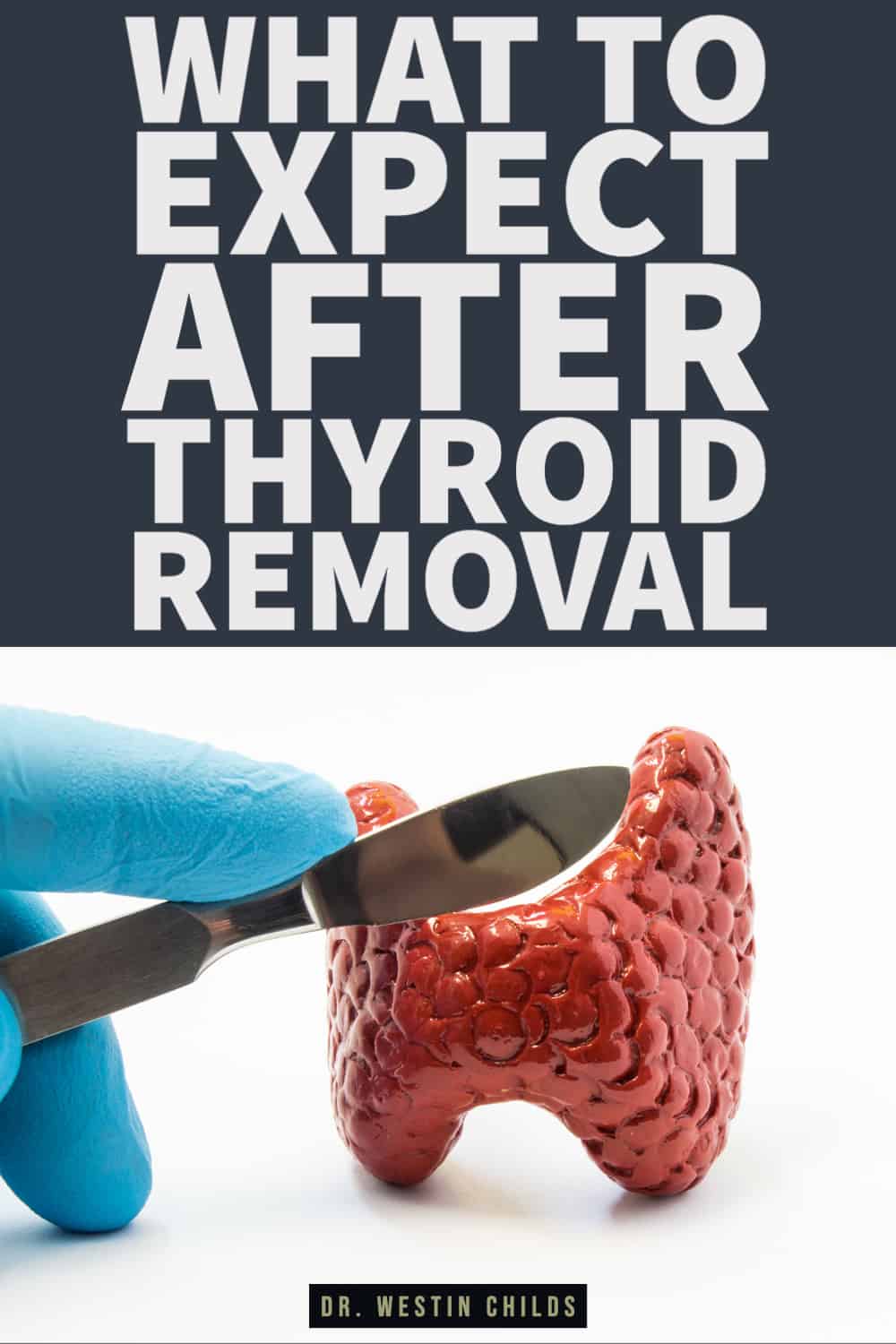 what to expect after thyroid removal