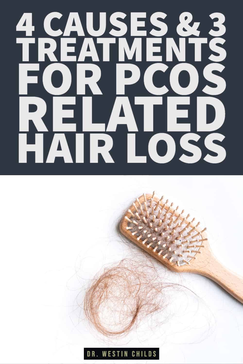 4 causes & 3 treatments for PCOS related hair loss