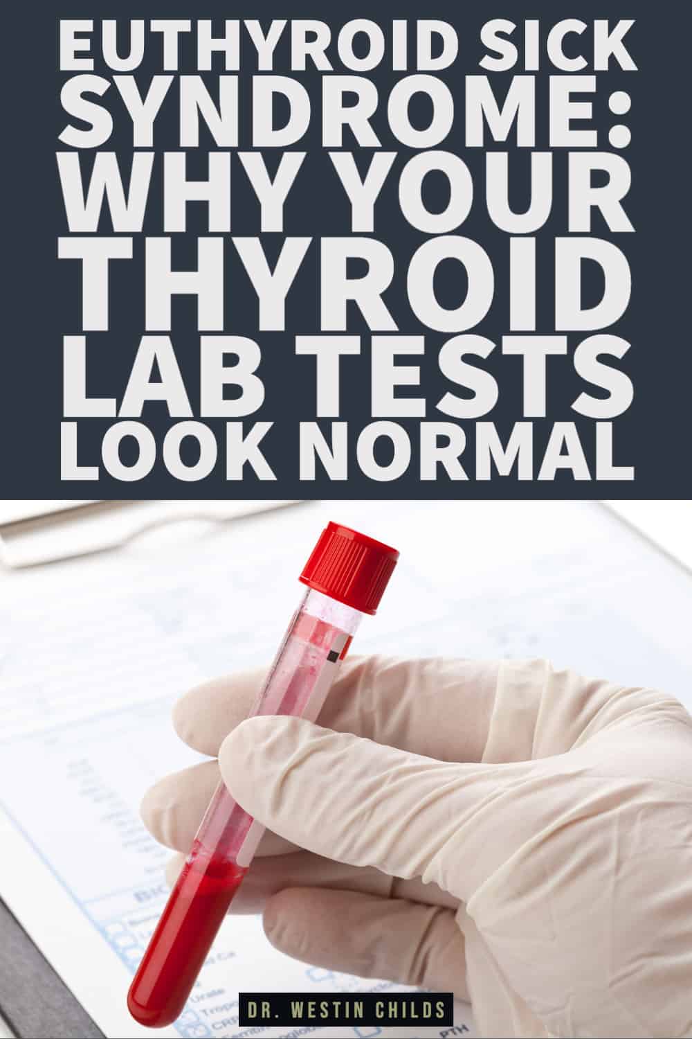 euthyroid sick syndrome why your thyroid lab tests look normal