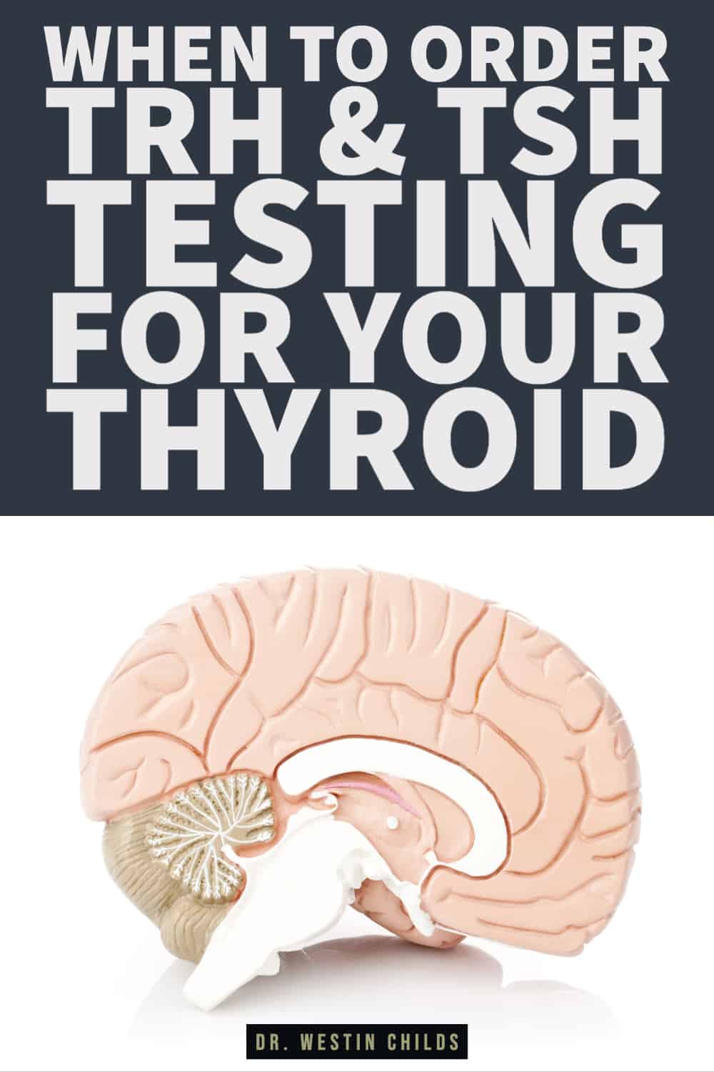 when to order TRH & TSH testing for your thyroid