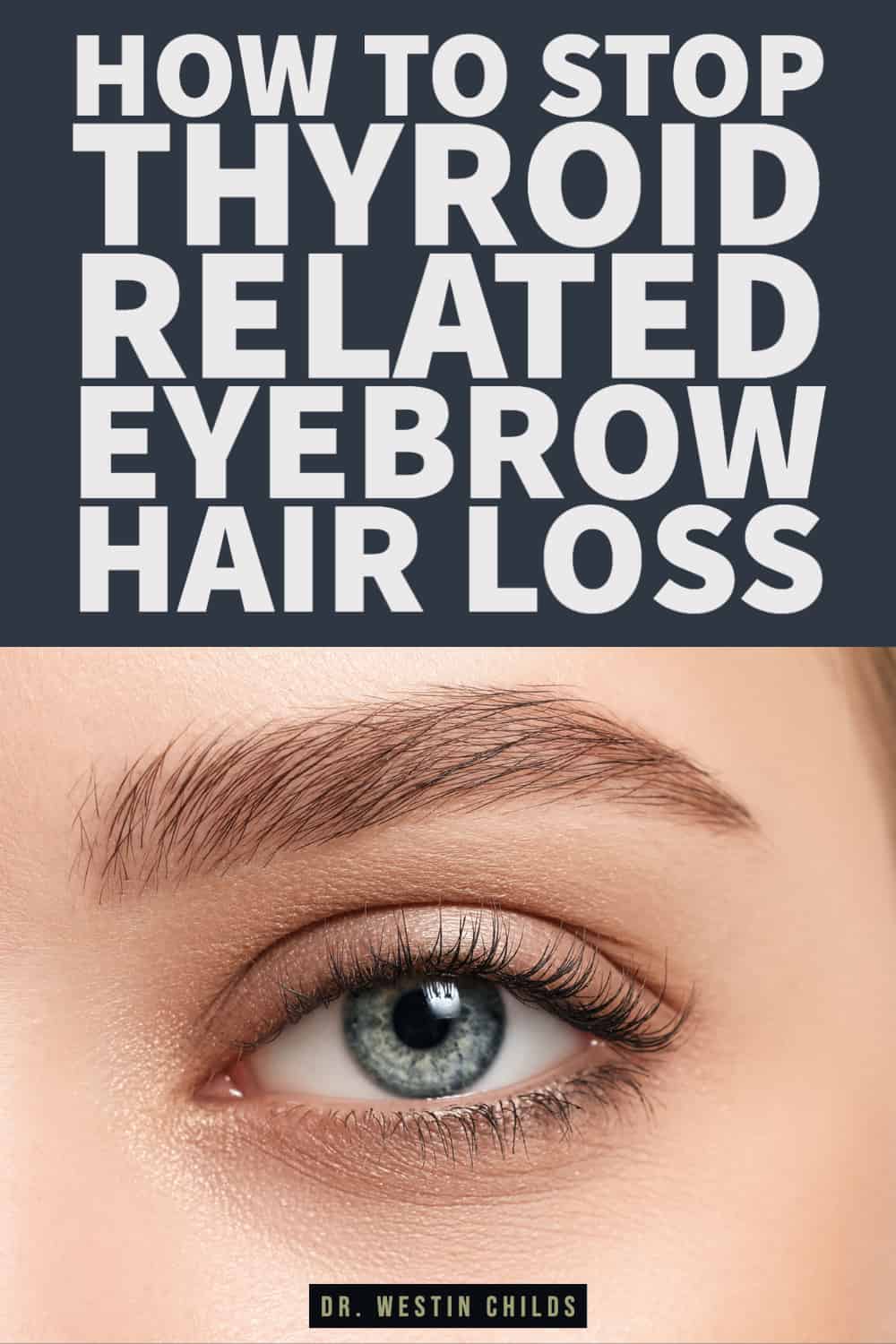 how to stop thyroid related eyebrow hair loss