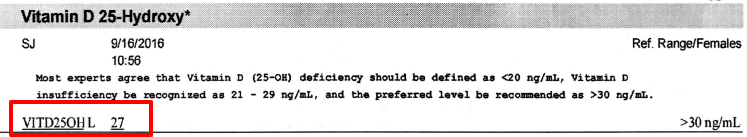sample 25 hydroxy vitamin d lab test result