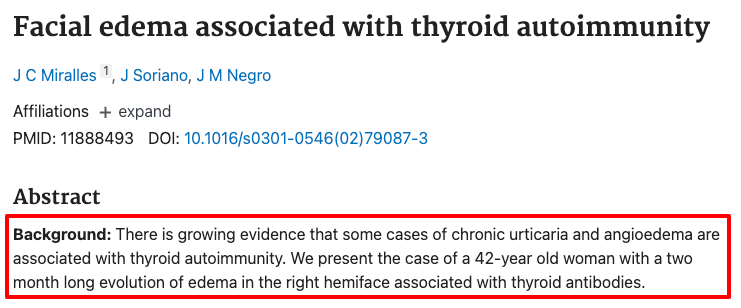 hypothyroidism is associated with angioedema and facial swelling