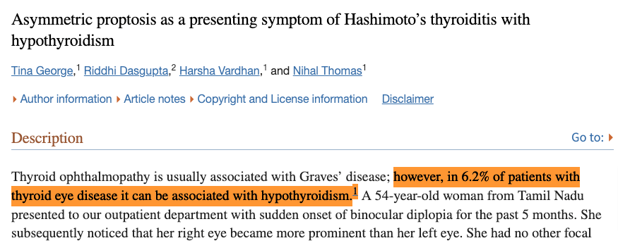 thyroid eye disease can occur in hypothyroidism as well as hyperthyroidism