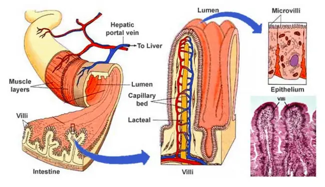 Leaky gut pictures