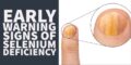 8 Early Symptoms of Selenium Deficiency & Your Next Steps