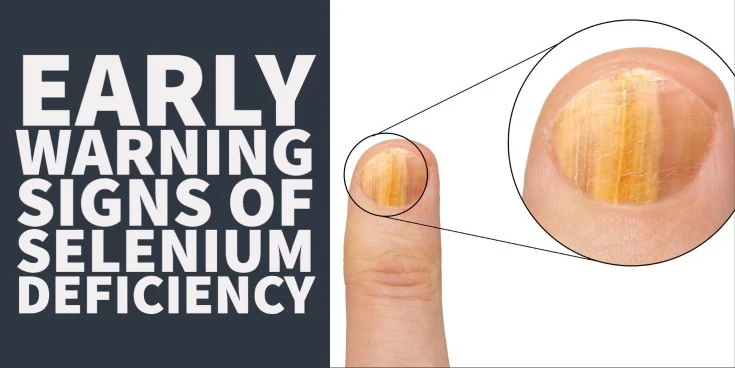 early warning signs of selenium deficiency