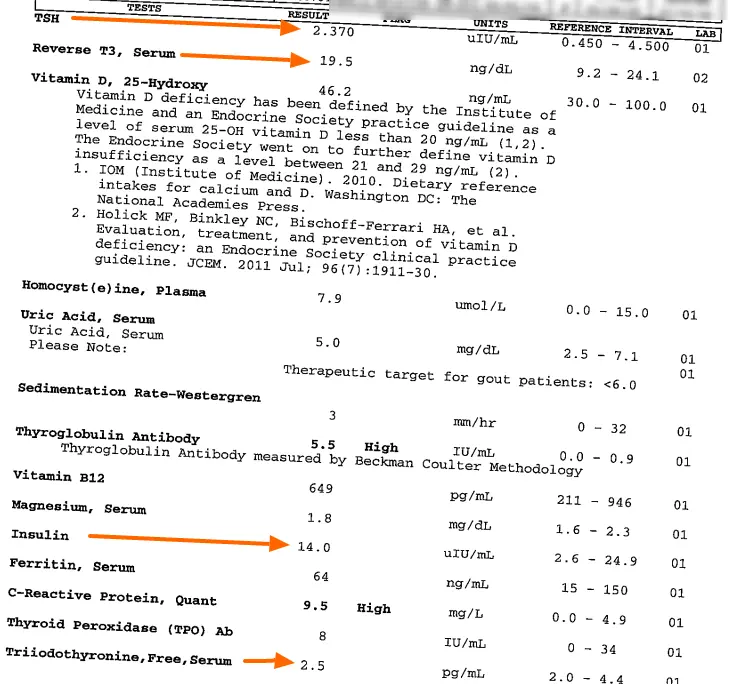 Thyroid Lab Results Chart