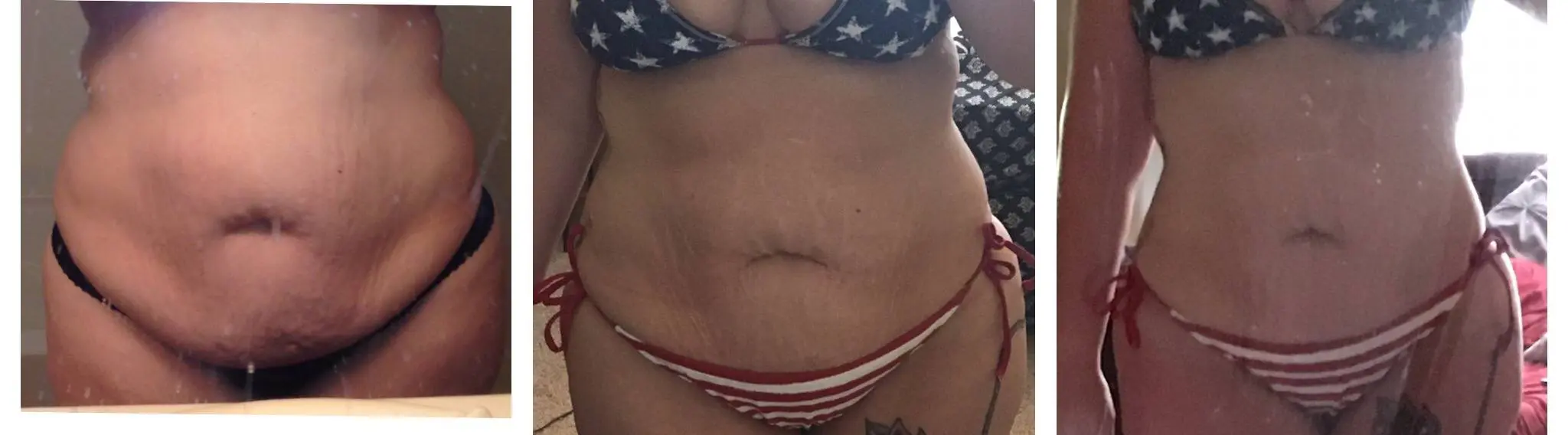 3 pictures of melanie showing her weight loss progress over time.