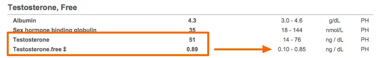 lab test results showing an example of a high free testosterone level and a high normal testosterone. 