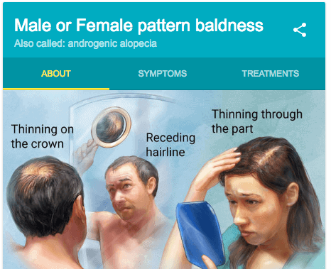 a woman and a man both suffering from male patterned baldness are shown looking at their hair in a mirror. 