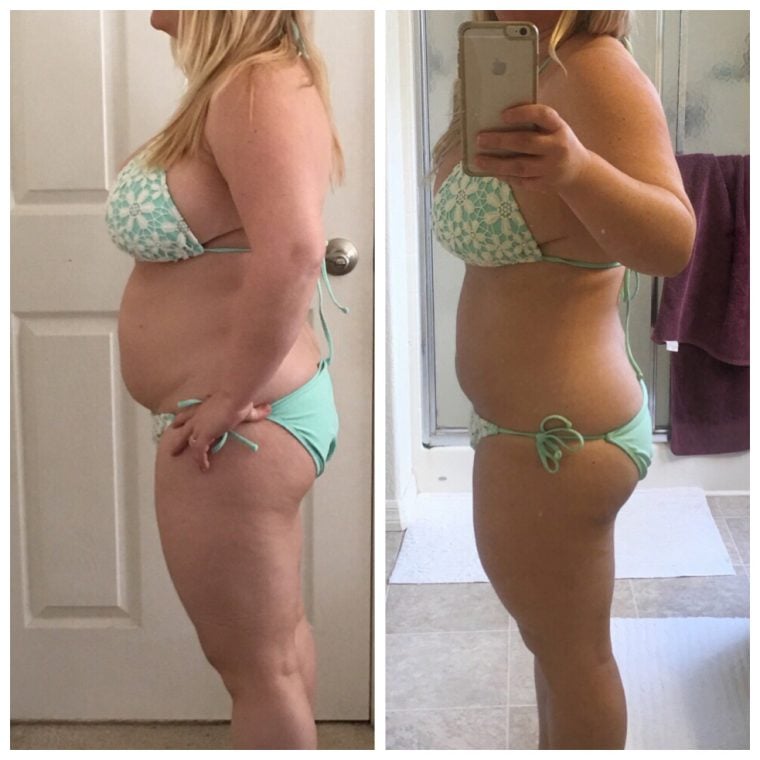 side by side before and after picture of thyroid weight loss