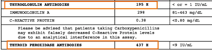 thyroid lab tests from a patient with hashimoto's showing elevated thyroglobulin and thyroid peroxidase antibodies. 