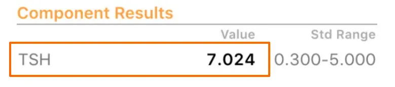 lab tests from a patient showing an elevated TSH level of 7.024. 