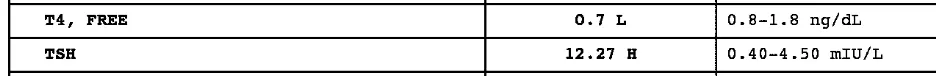 High free T4 and low TSH in hashimoto's