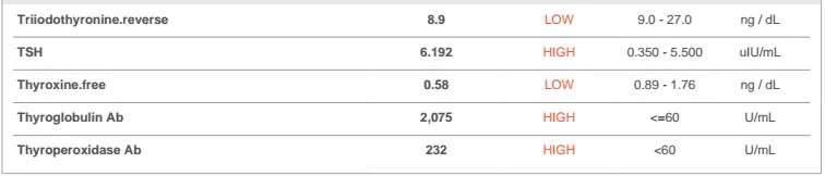 thyroid lab tests in a male patient showing a low reverse t3, a high TSH, a low free t4, and elevated thyroglobulin and thyroid peroxidase antibodies. 