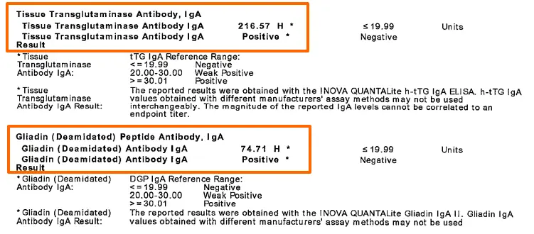 Tpo Levels Chart