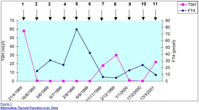 a graph which shows TSH levels and free t4 levels over time in a patient with hashimoto's. 