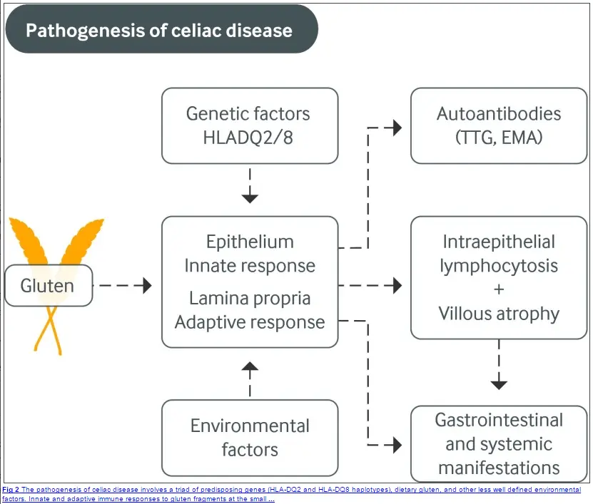 a chart that shows the pathogenesis of celiac disease starting with the intake of gluten. 