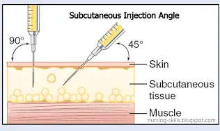 diagram which shows how to give a subcutaneous injection at the correct depth. 