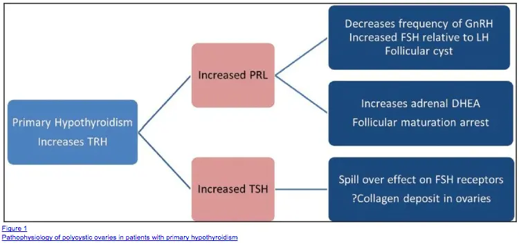 a diagram showing the relationship that primary hypothyroidism has on polycystic ovaries. 