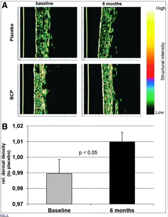 Collagen peptides improve collagen production in the dermis