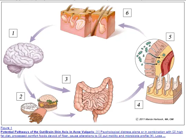 a schematic detailing the connection between food consumption, gut health, and brain health. 