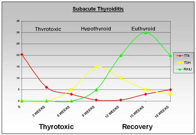 Subacute thyroiditis graph with lab tests over time