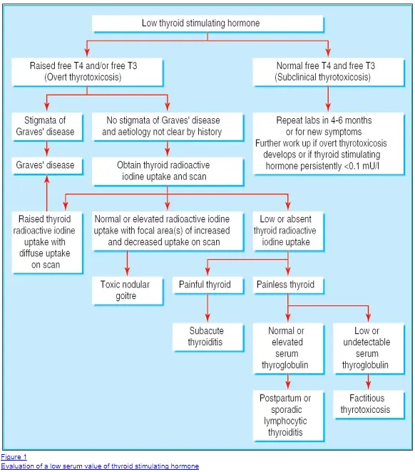 causes and management of thyrotoxicosis