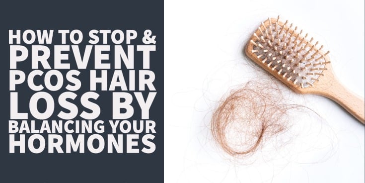 How to Stop & Prevent PCOS Hair Loss By Balancing Your Hormones