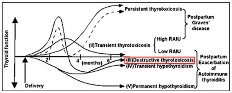 thyroid disease during and after pregnancy in women