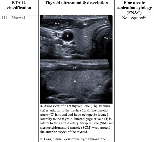 picture of thyroid cyst on ultrasound imaging