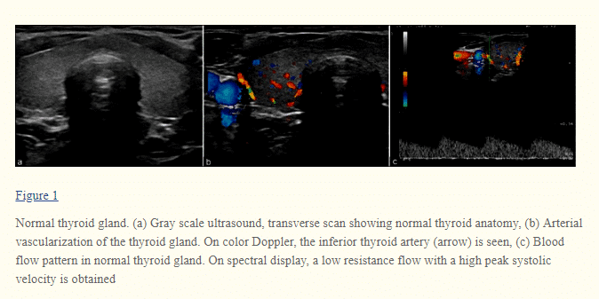 what your thyroid gland looks like during ultrasound testing