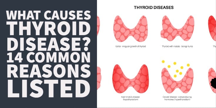 What Causes Thyroid Disease: 14 Common Reasons Listed