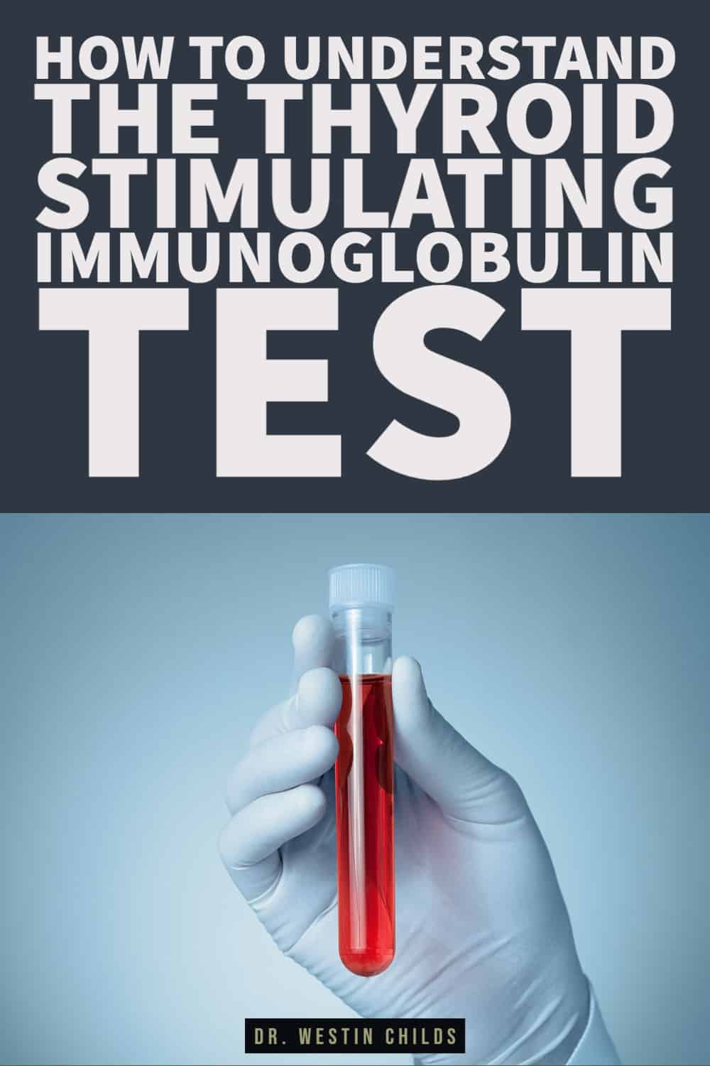 how to understand the thyroid stimulating immunoglobulin test