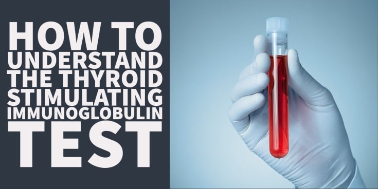 understanding and interpreting the thyroid stimulating immunoglobulin thyroid lab test