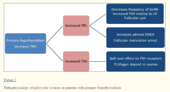 hypothyroidism and PCOS