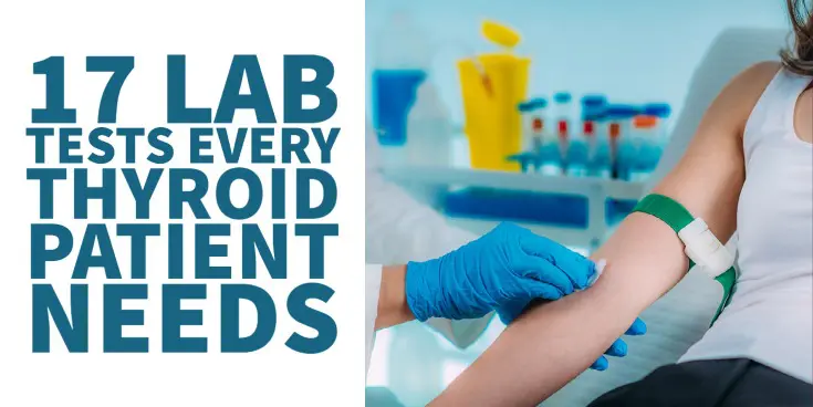 lab tests every thyroid patients needs