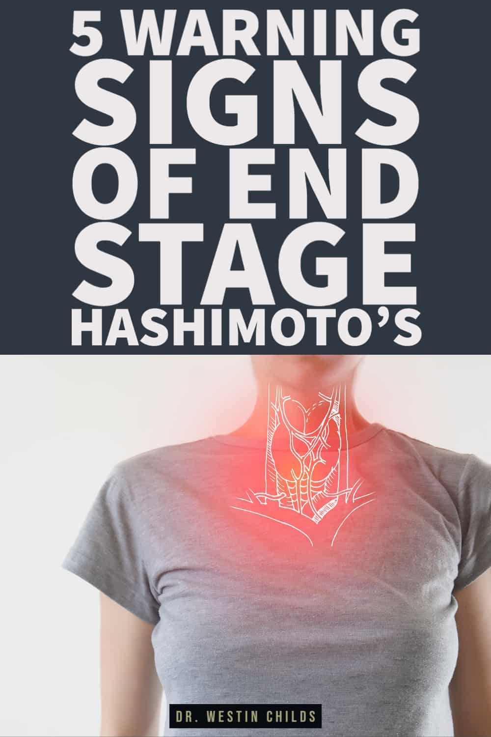 signs of thyroid gland atrophy and end stage hashimoto's