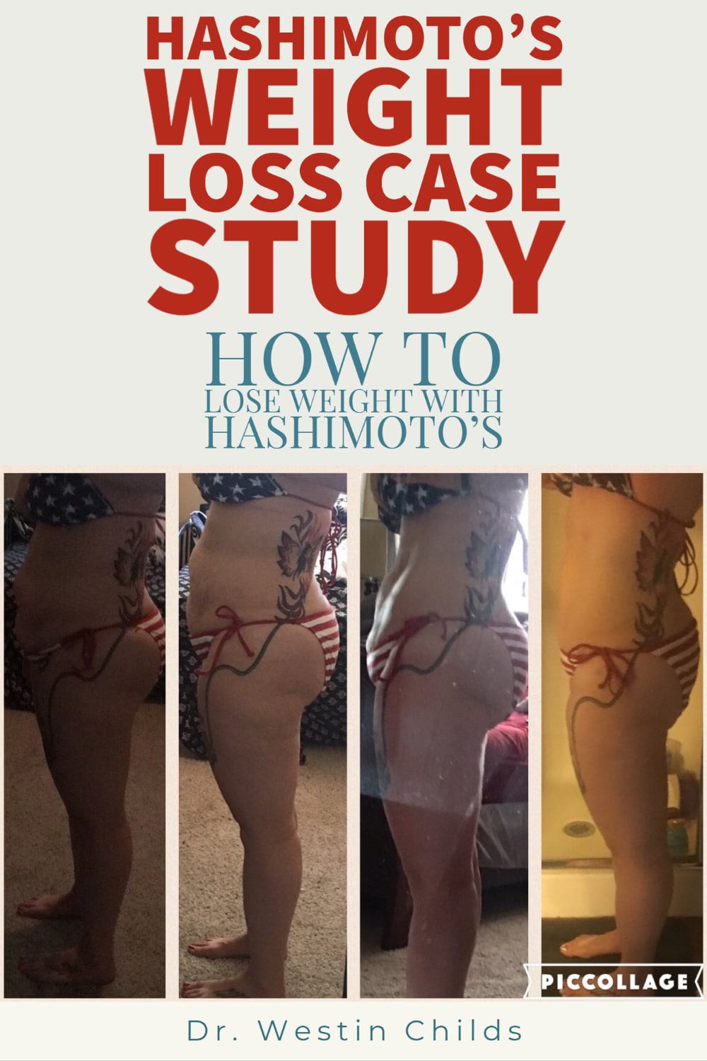 hashimoto's weight loss case study pinterest image. 