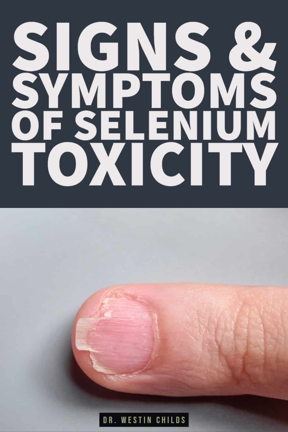 warnings signs you are taking too much selenium