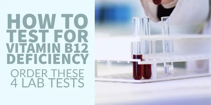 how to test for vitamin b12 deficiency