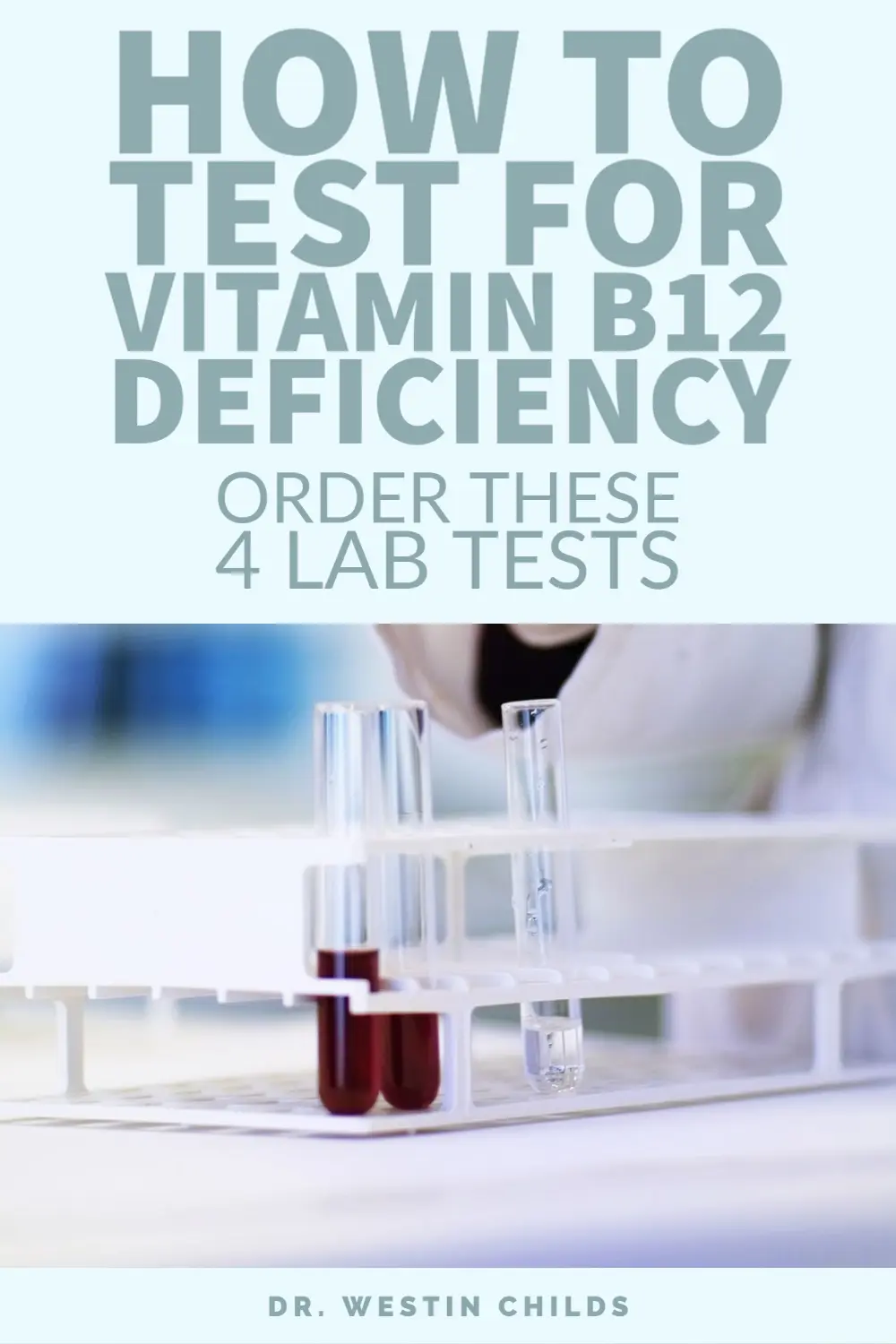 these 4 tests are required to diagnose vitamin b12 deficiency