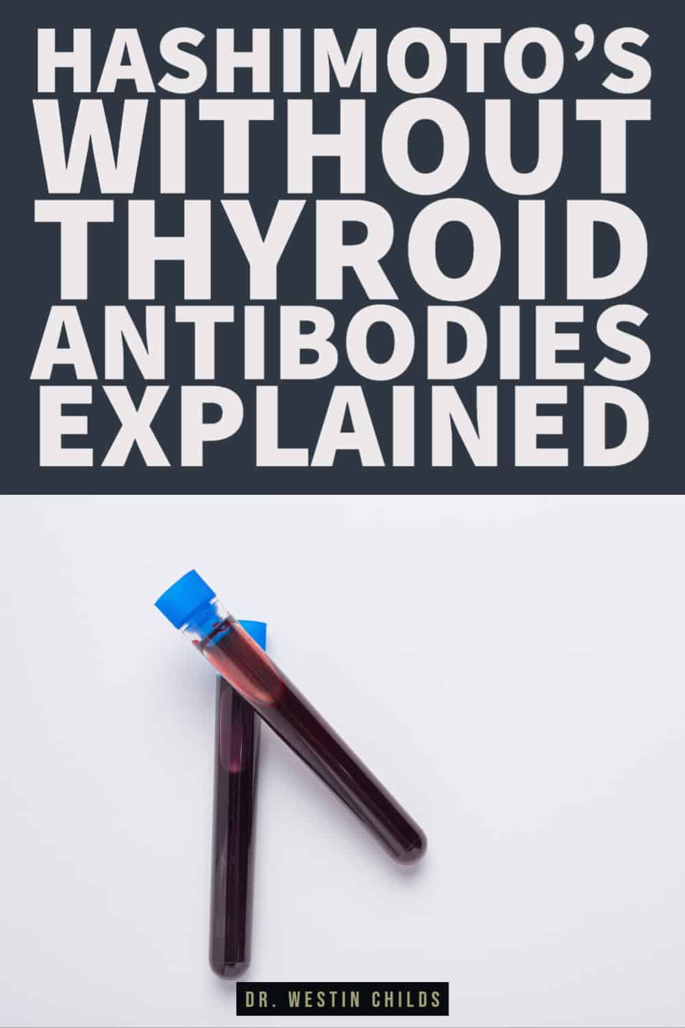 conditions that cause hashimoto's without thyroid antibodies