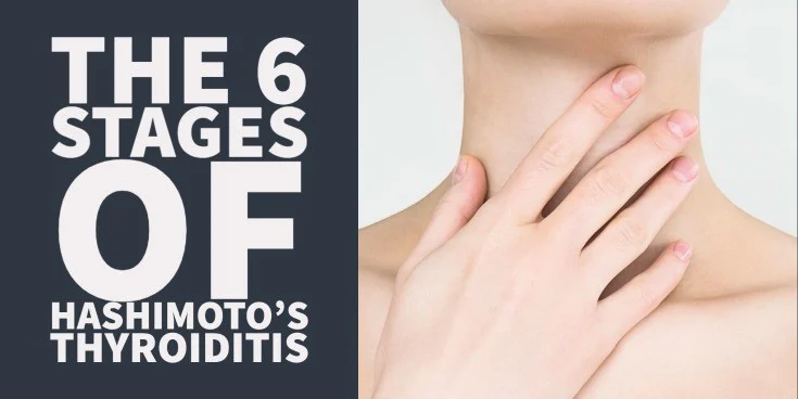 the 6 stages of hashimoto's thyroiditis