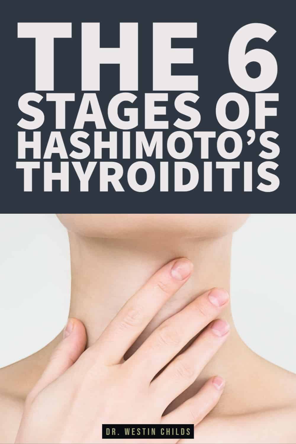 the stages of hashimoto's thyroiditis explained